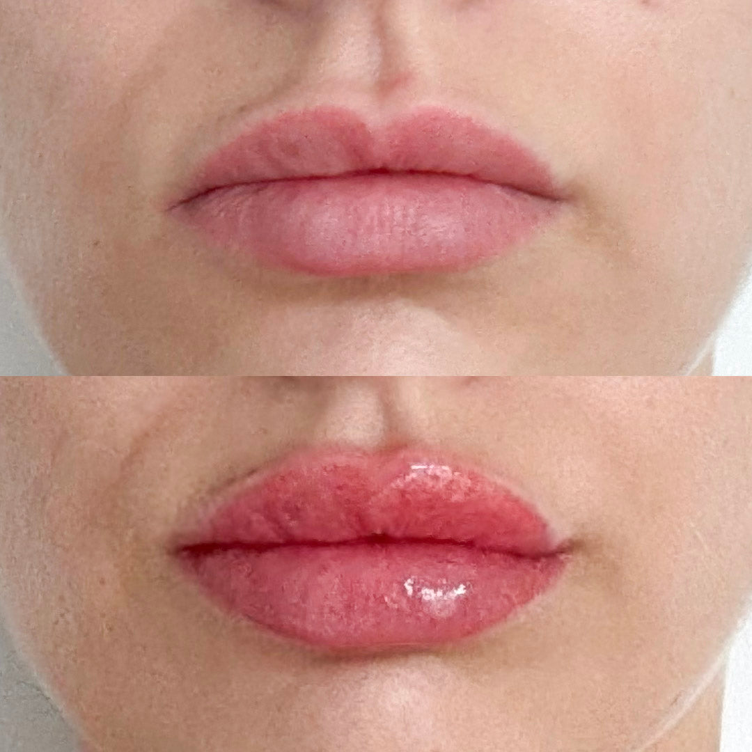 Ant'O - Repulpant Lèvres